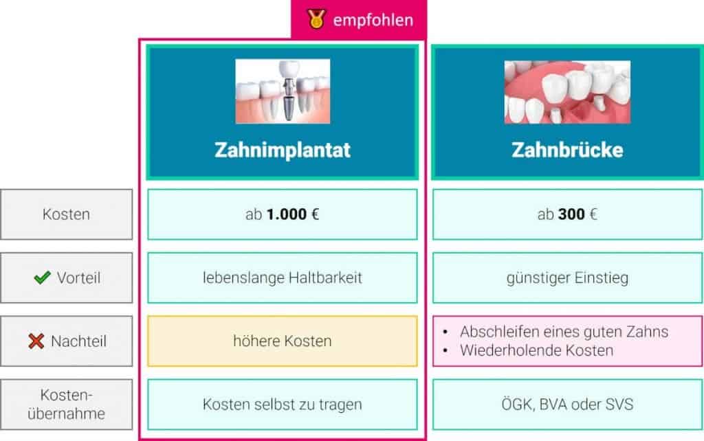 zahnimplantat zahnbrücke